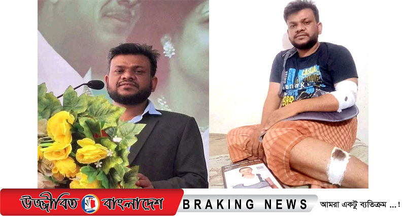 সড়ক দুর্ঘটনায় আহত না.গঞ্জ জেলা স্বেচ্ছাসেবকদল নেতা নাজমুল হাসান বাবু